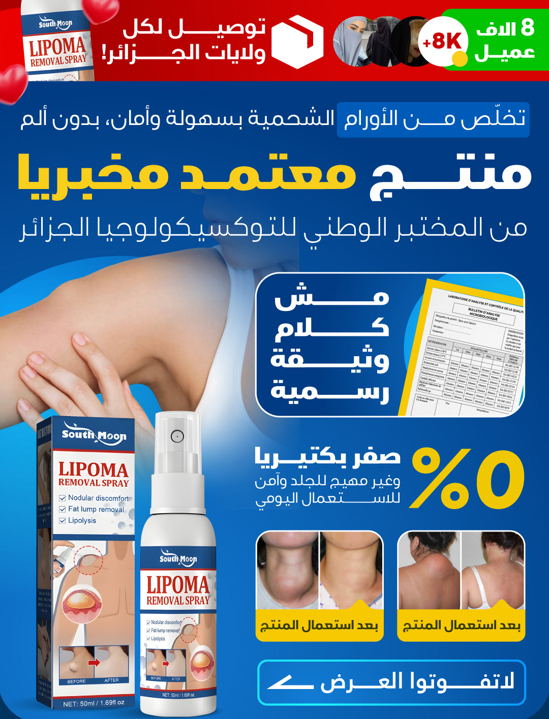 بخاخ ازالة الاورام الشحمية الفورية - lipoma new lp landify